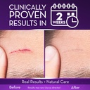 cicatricure-advanced-scar-gel-for-face-b-3.jpg