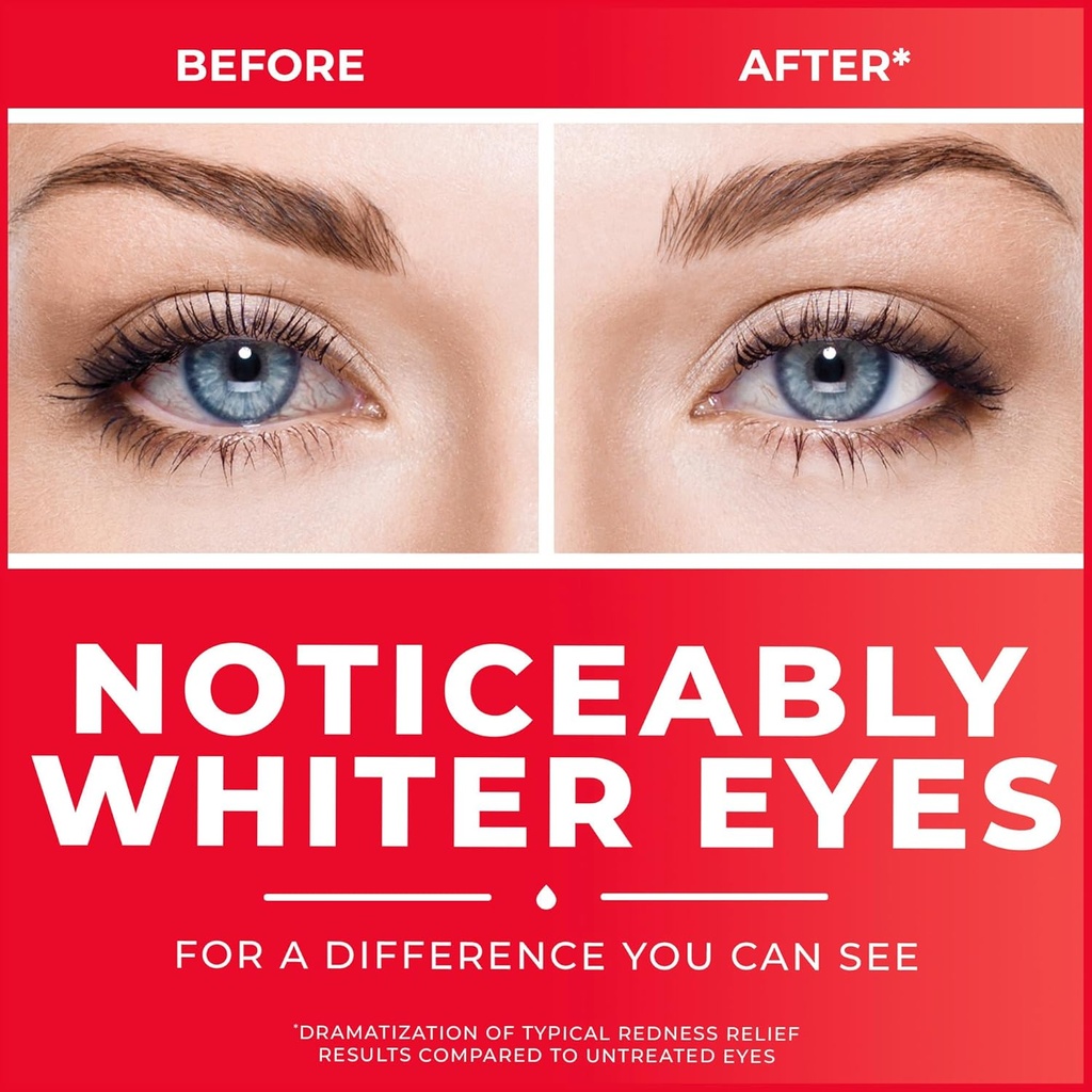 clear-eyes-redness-eye-relief-eye-drops--3.jpg