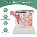 ultrassist-human-anatomy-osteoporosis-mo-2.jpg