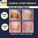 nonyx-fungal-nail-clarifying-gel-clinica-4.jpg