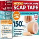 Medical Grade Silicone Scar Tape - 1.6”x150” - Visible Difference on Keloid & С-Section - Reusable Silicone Scar Sheets - Easy to Use